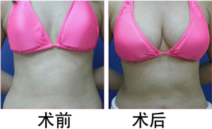 第1835页