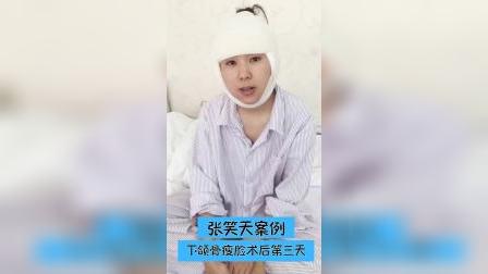眼皮 第310页