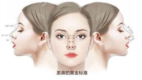 瑞兰隆鼻，重塑自然美鼻的艺术