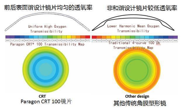 角膜塑形镜，品牌与价格的深度解析