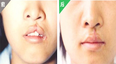 鼻子 第294页