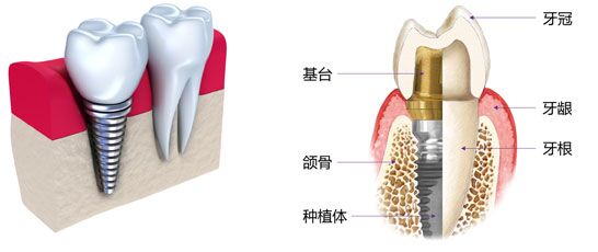 牙齿 第291页
