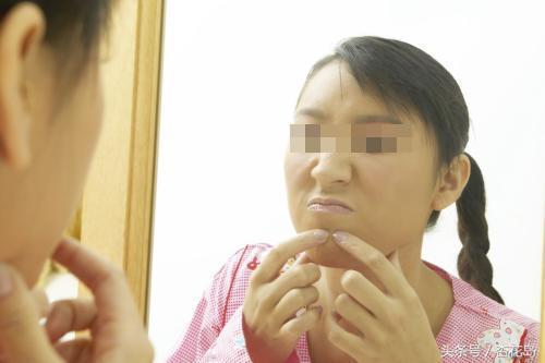 青春痘的困扰与解惑，走进专业青春痘医院的探索之旅