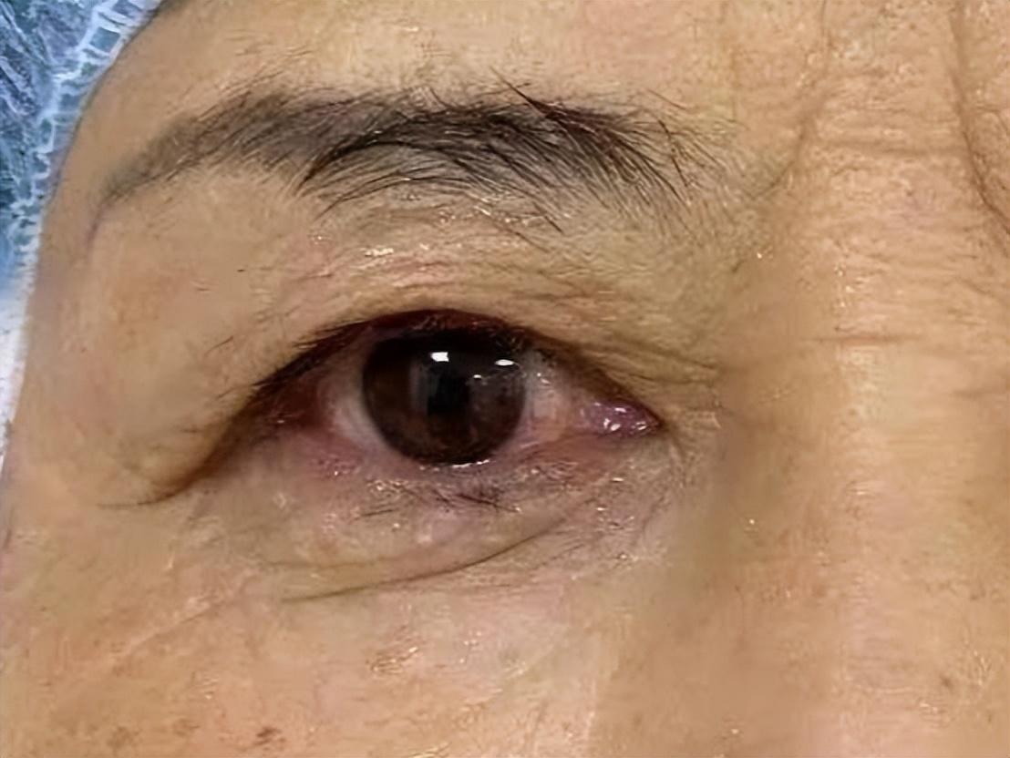 提眉术，重塑眉形，焕发自信的美丽秘诀