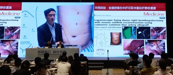 毛发种植技术，重塑自信的现代医学奇迹