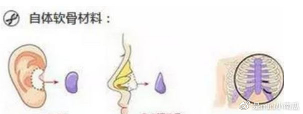美丽隐忧